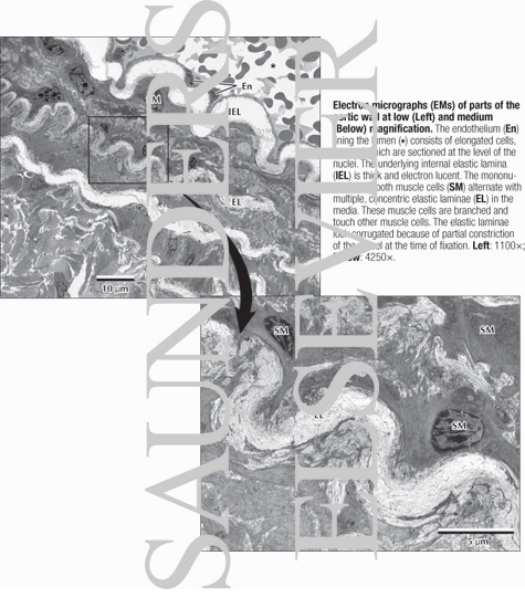 Watermarked preview of labeled image: Electron Micrographs of Parts of the Aortic Wall at Low (Left) and Medium (Below) Magnification