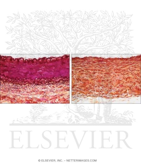 Watermarked preview of unlabeled image: Light Micrographs of the Wall of a Muscular Artery (Left) and Muscular Vein (Right)