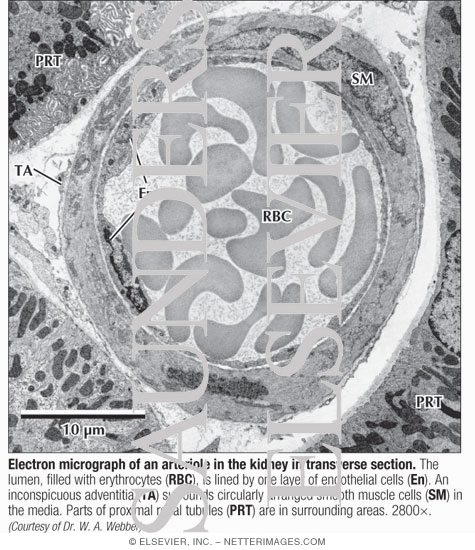 Electron micrograph labeled