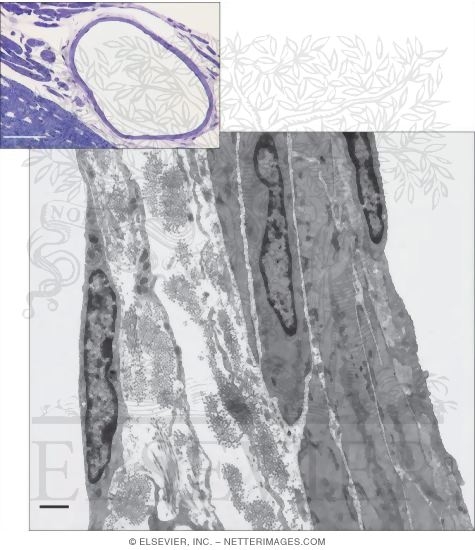 An Arteriole and a Venule In Transverse Section With an Electron Micrograph of Walls of an Arteriole and a Venule