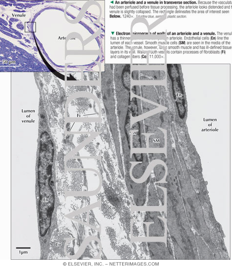 Watermarked preview of labeled image: An Arteriole and a Venule In Transverse Section With an Electron Micrograph of Walls of an Arteriole and a Venule