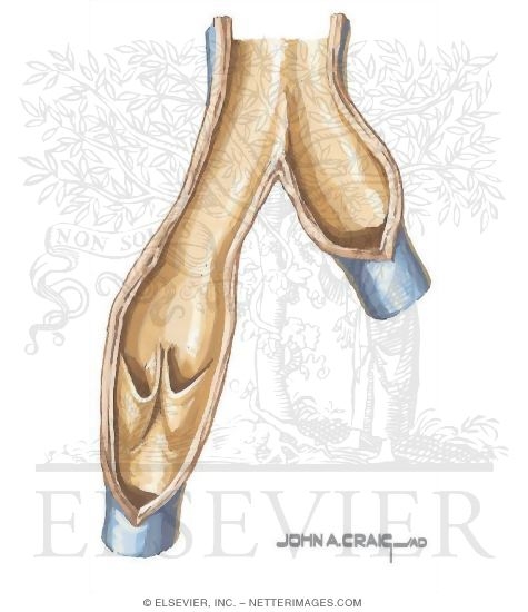 Watermarked preview of unlabeled image: Venous Thrombosis