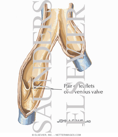 Watermarked preview of labeled image: Venous Thrombosis
