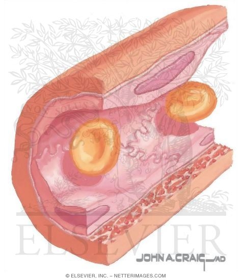 Watermarked preview of unlabeled image: Electron Micrograph of Part of an Arteriole