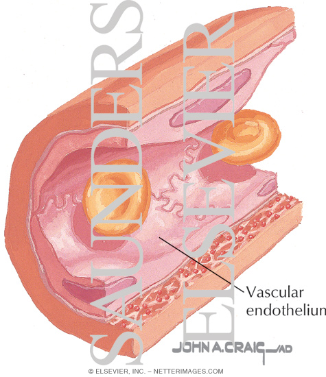 Watermarked preview of labeled image: Electron Micrograph of Part of an Arteriole