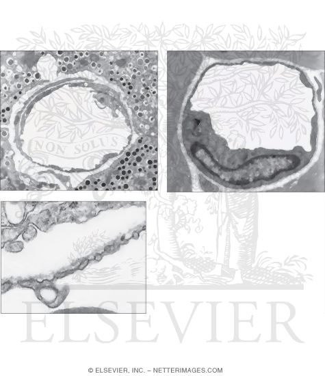 Electron Micrographs of Fenestrated Capillaries In the Endocrine Pancreas In Transverse Section