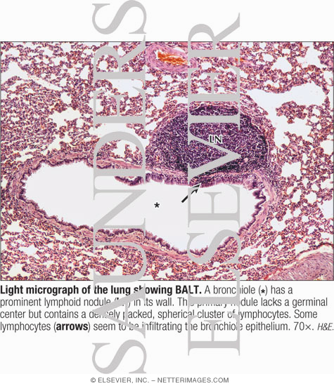 Light Micrograph of the Lung Showing BALT