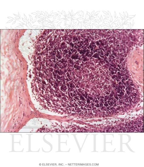 Watermarked preview of unlabeled image: Higher Magnification Light Micrograph of Part of a Lymph Node Cortex