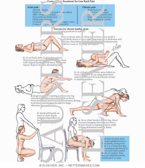 Watermarked preview of labeled image: Treatment of Lumbar Strain
Conservative Treatment for Low Back Pain