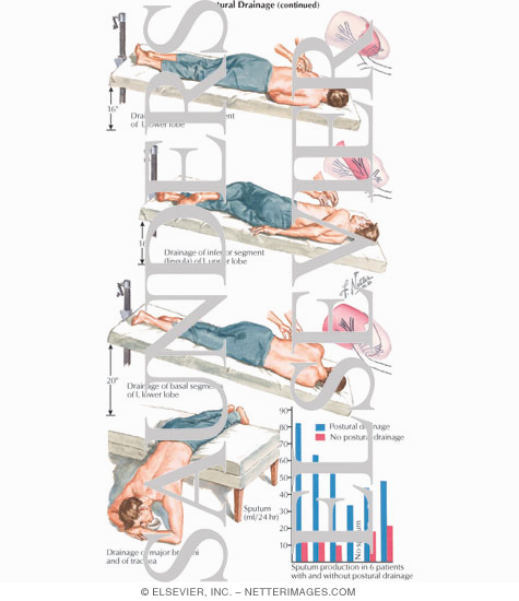 Watermarked preview of labeled image: Postural Drainage