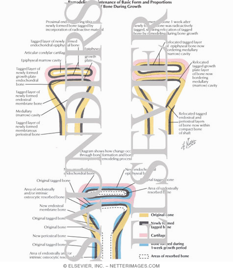 Watermarked preview of labeled image: Remodeling:  Maintenance of Basic Form and Proportions of Bone During Growth