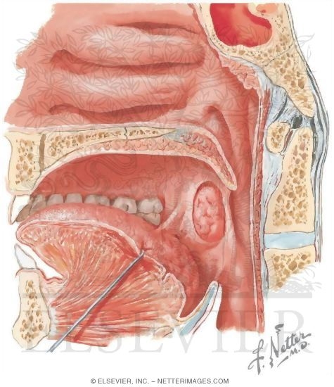 palatine tonsils