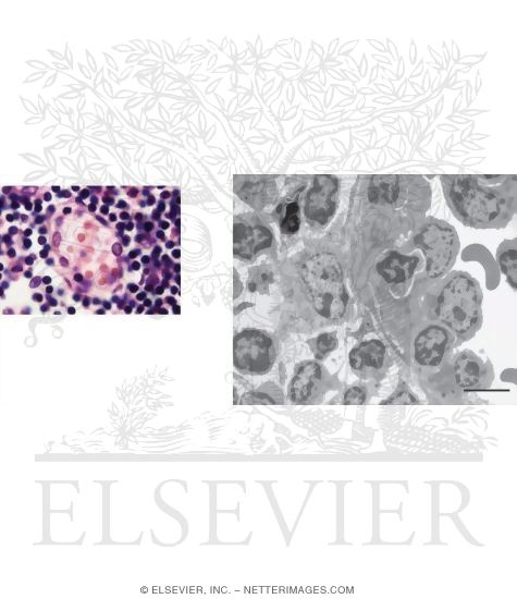 Watermarked preview of unlabeled image: Light Micrograph of a High Endothelial Venule In the Paracortex of a Lymph Node With Electron Micrograph Showing Key Features of a High Endothelial Venule In the Paracortex of a Lymph Node