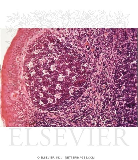 Light Micrograph of a Lymphoid Nodule In the Palatine Tonsil