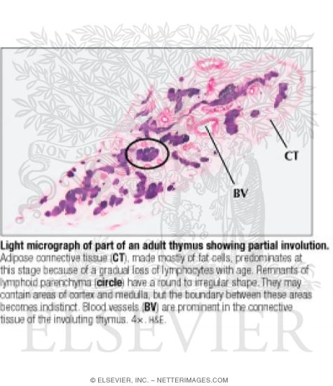 Light Micrograph of Part of an Adult Thymus Showing Partial Involution