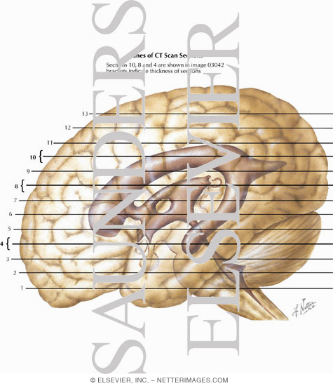Planes of CT Scan Sections