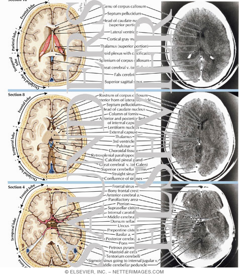 Normal Brain Anatomy as Demonstrated by Computerized Tomography (CT Scanning)