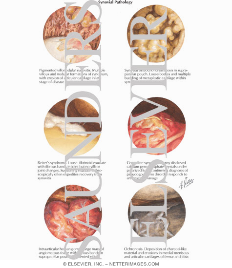 Watermarked preview of labeled image: Synovial Pathology
