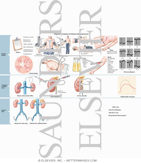 Diagnostic Evaluation of Patients with Hypertension
