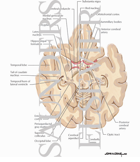 Watermarked preview of unlabeled image: Horizontal Forebrain Sections (Level 4 of 10)