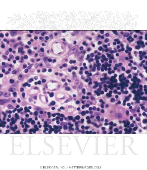 Watermarked preview of unlabeled image: Light Micrograph of Part of the Cortex of a Child’s Thymus at High Magnification