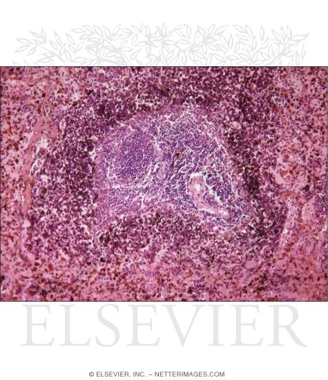 Light Micrograph of Rat Spleen Showing White and Red Pulp After Injection of India Ink