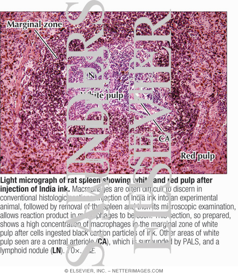 Light Micrograph of Rat Spleen Showing White and Red Pulp After Injection of India Ink