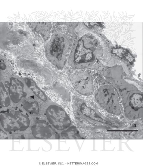 Electron Micrograph of Part of a Central Arteriole In White Pulp