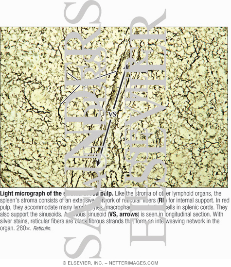 Light Micrograph of the Stroma of Red Pulp