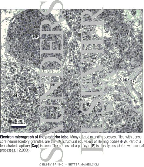 Watermarked preview of labeled image: Electron Micrograph of the Posterior Lobe