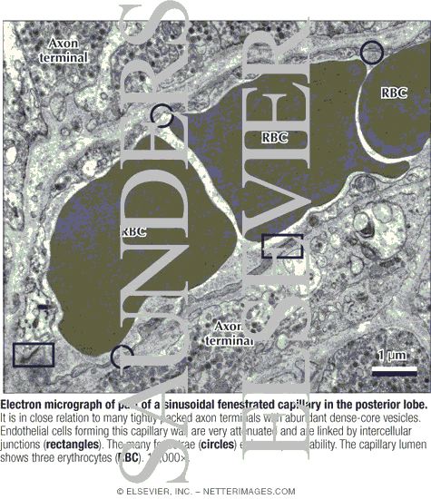 Watermarked preview of labeled image: Electron Micrograph of Part of a Sinusoidal Fenestrated Capillary In the Posterior Lobe