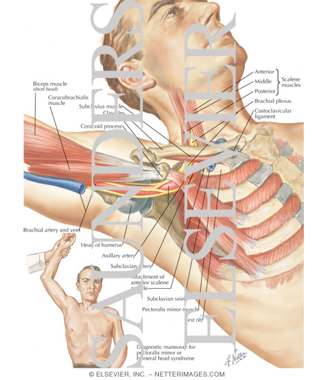 Pressure Exerted By Pectoralis Minor In Hyperabduction Syndrome