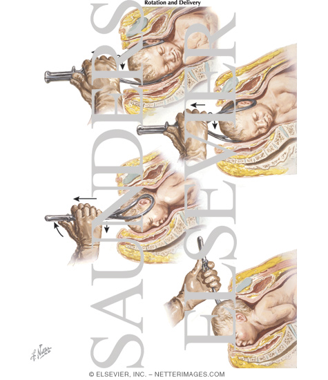 Watermarked preview of labeled image: Rotation and Delivery