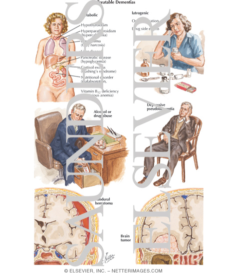 Watermarked preview of labeled image: Treatable Dementias