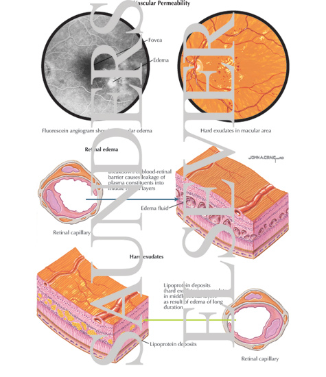 Vascular Permeability