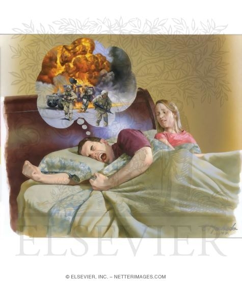 Posttraumatic Stress Disorder (PTSD)