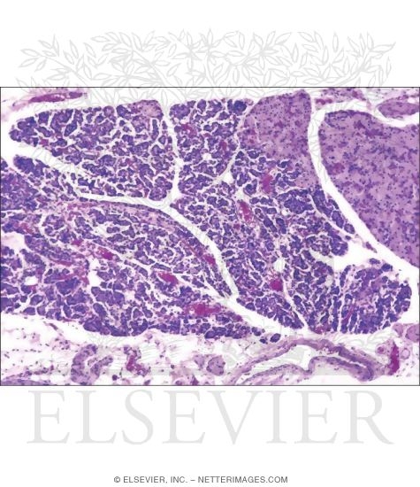 Watermarked preview of unlabeled image: Light Micrograph of Part of the Parathyroid