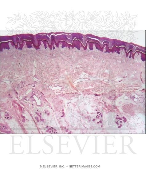 Light Micrograph of Thick Skin Showing Its Architectural Organization In Vertical Section at Low Power