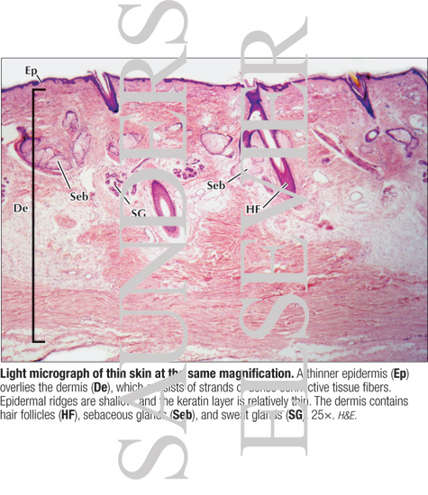 Light Micrograph of Thin Skin at the Same Magnification