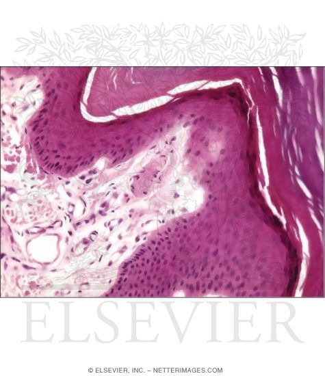 Light Micrograph of Thick Skin at the Dermoepidermal Junction