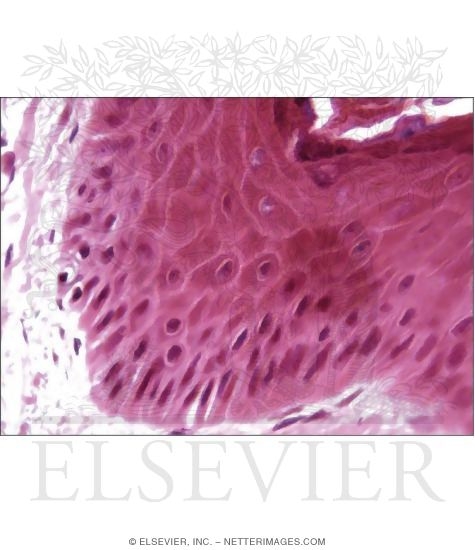 Watermarked preview of unlabeled image: Higher Magnification Light Micrograph of the Epidermis of Thick Skin