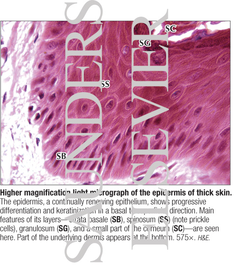 Watermarked preview of labeled image: Higher Magnification Light Micrograph of the Epidermis of Thick Skin