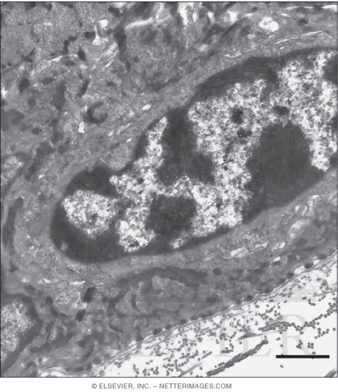 Watermarked preview of unlabeled image: Low-magnification Electron Micrograph of the Dermoepidermal Junction