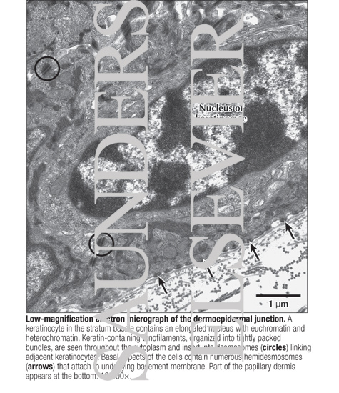 Watermarked preview of labeled image: Low-magnification Electron Micrograph of the Dermoepidermal Junction
