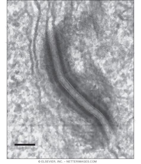 Watermarked preview of unlabeled image: High Magnification Electron Micrograph Showing Details of a Desmosome Between Adjacent Keratinocytes
