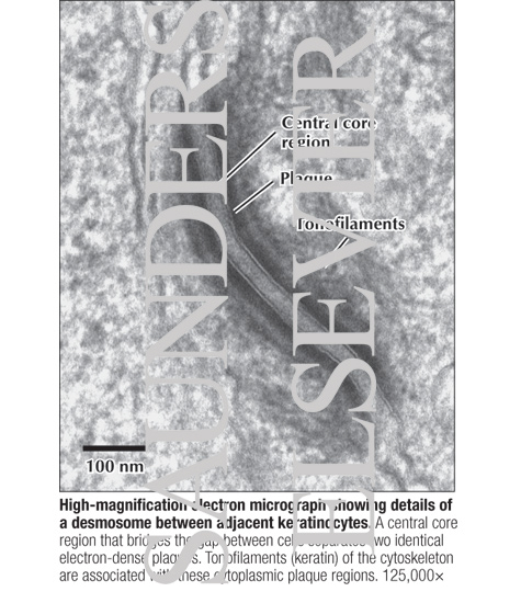 Watermarked preview of labeled image: High Magnification Electron Micrograph Showing Details of a Desmosome Between Adjacent Keratinocytes