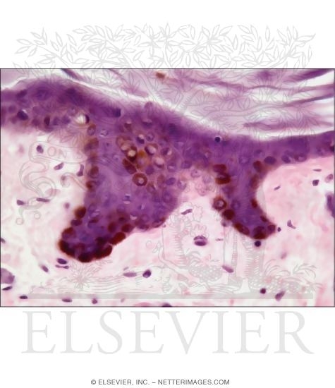 Light Micrograph of the Epidermis and Dermis of Heavily Pigmented Thick Skin