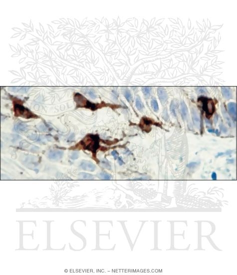 Watermarked preview of unlabeled image: Immunostained Light Micrograph of Thick Skin Showing Melanocytes In the Epidermis