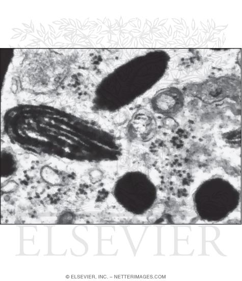Watermarked preview of unlabeled image: Electron Micrograph of Pigment Granules