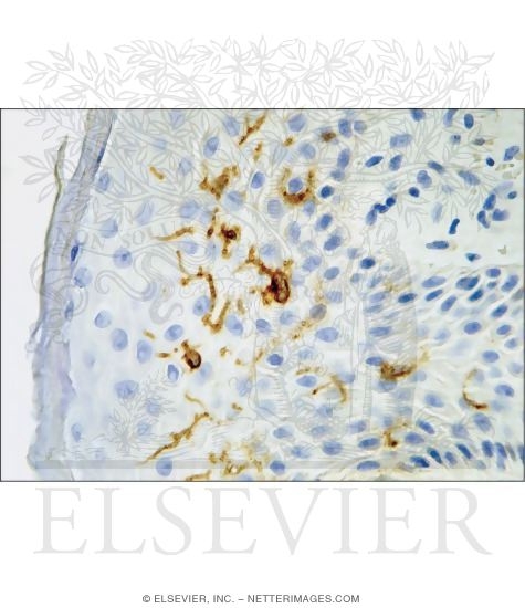 Light Micrograph of the Epidermis Containing Langerhans Cells